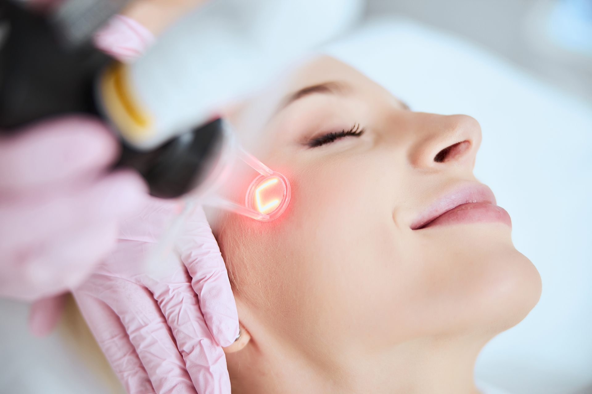 SECRET™ RESURFACING LASERLaser|Beauty|Skin|peel|injection|tatoo  removal|mesotherapy|CM Slim|HIFU|Hydradermabrasion