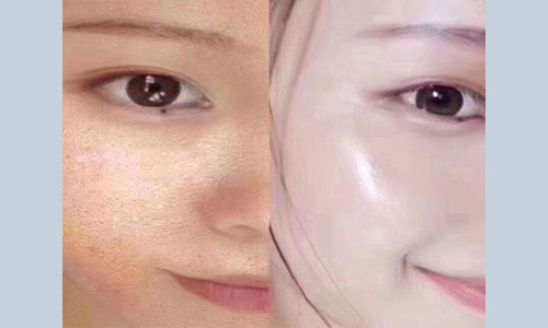 f2