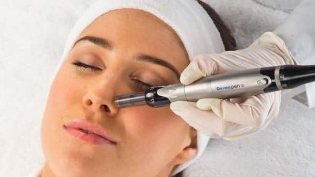 Mesotherapy-VS-Dermapen-skin-needling-Whats-the-difference-min